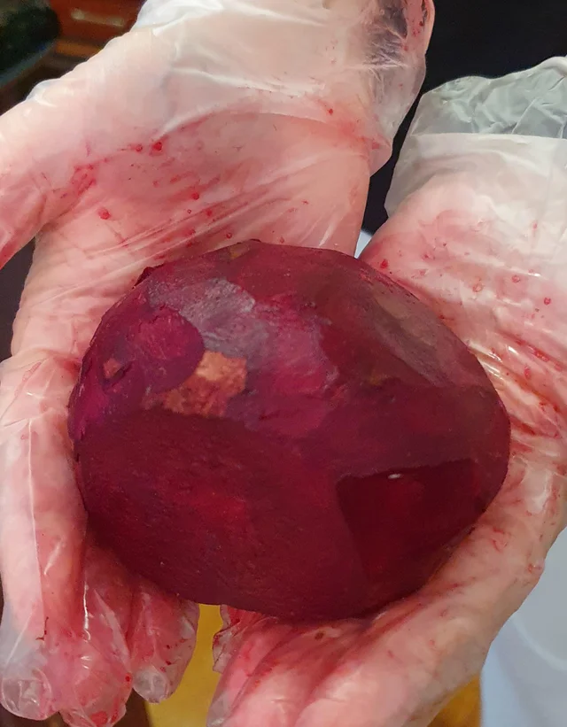 Heart before transplant